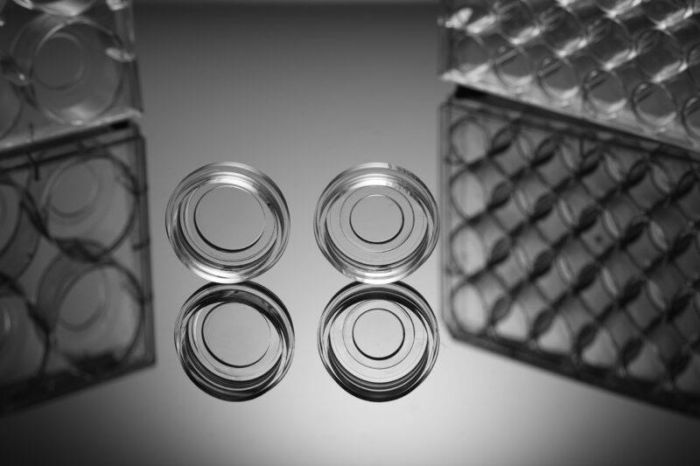 NEST Cell Culture Dishes\/ Plates Glass Bottom